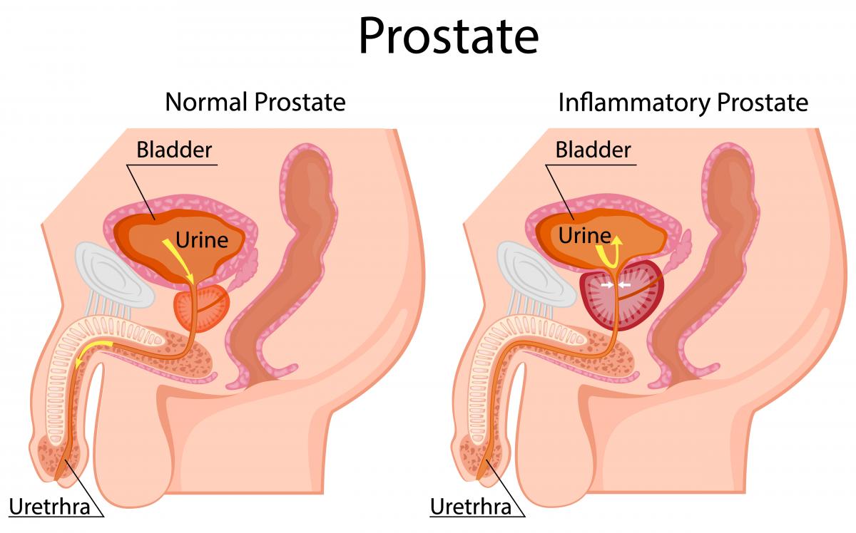 болит простата при оргазме фото 6
