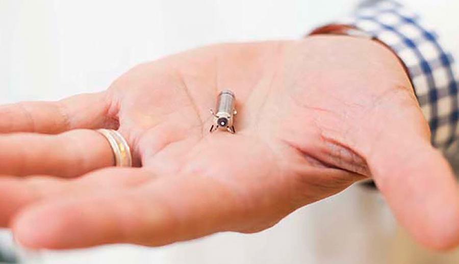 Самый маленький кардиостимулятор в мире теперь можно имплантировать и в Бельгии