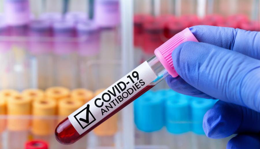 анализ крови на антитела к коронавирусу