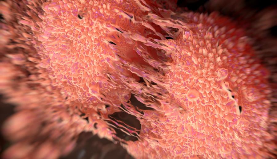 Деление раковых клеток предстательной железы в заключительной стадии деления цитоплазмы клеток (цитокинеза)